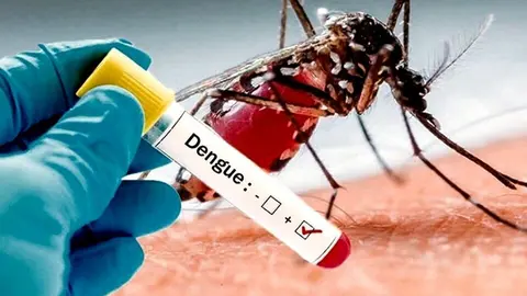 Dengue